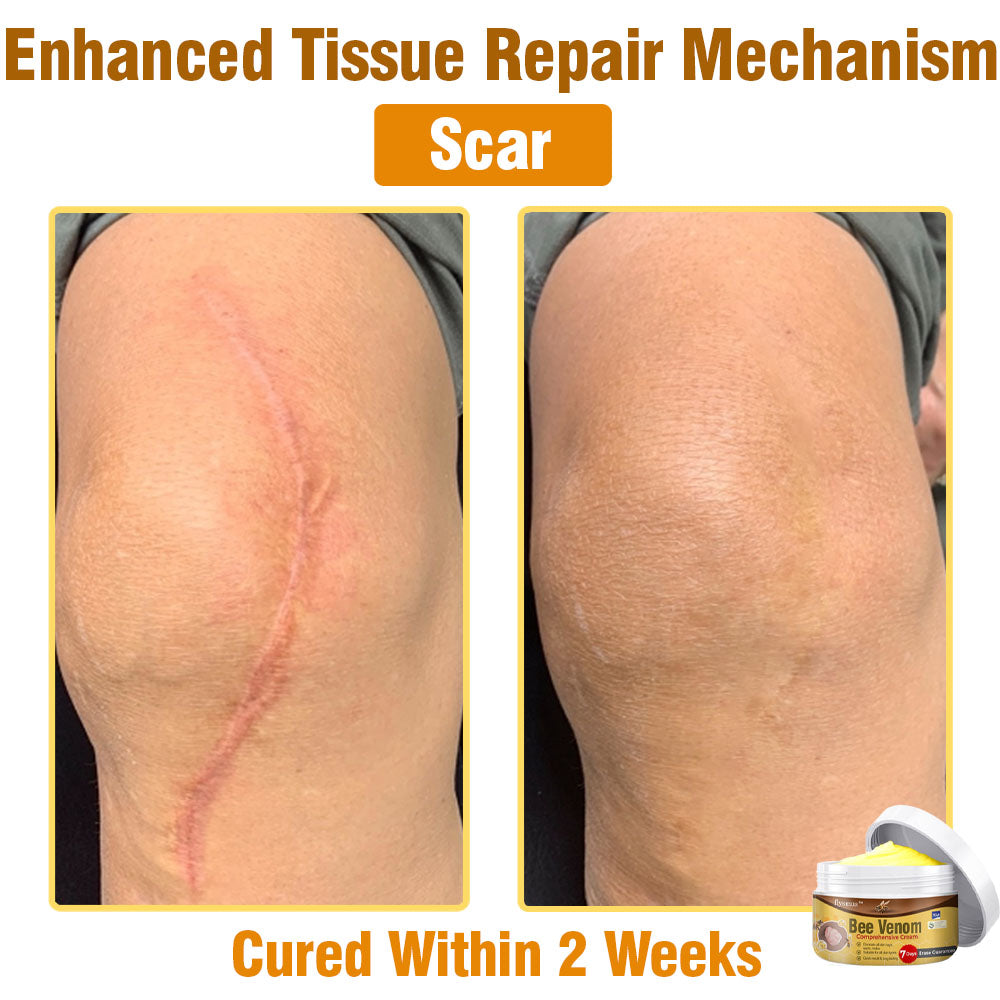 🐝 flysmus® Bee Venom Comprehensive Cream