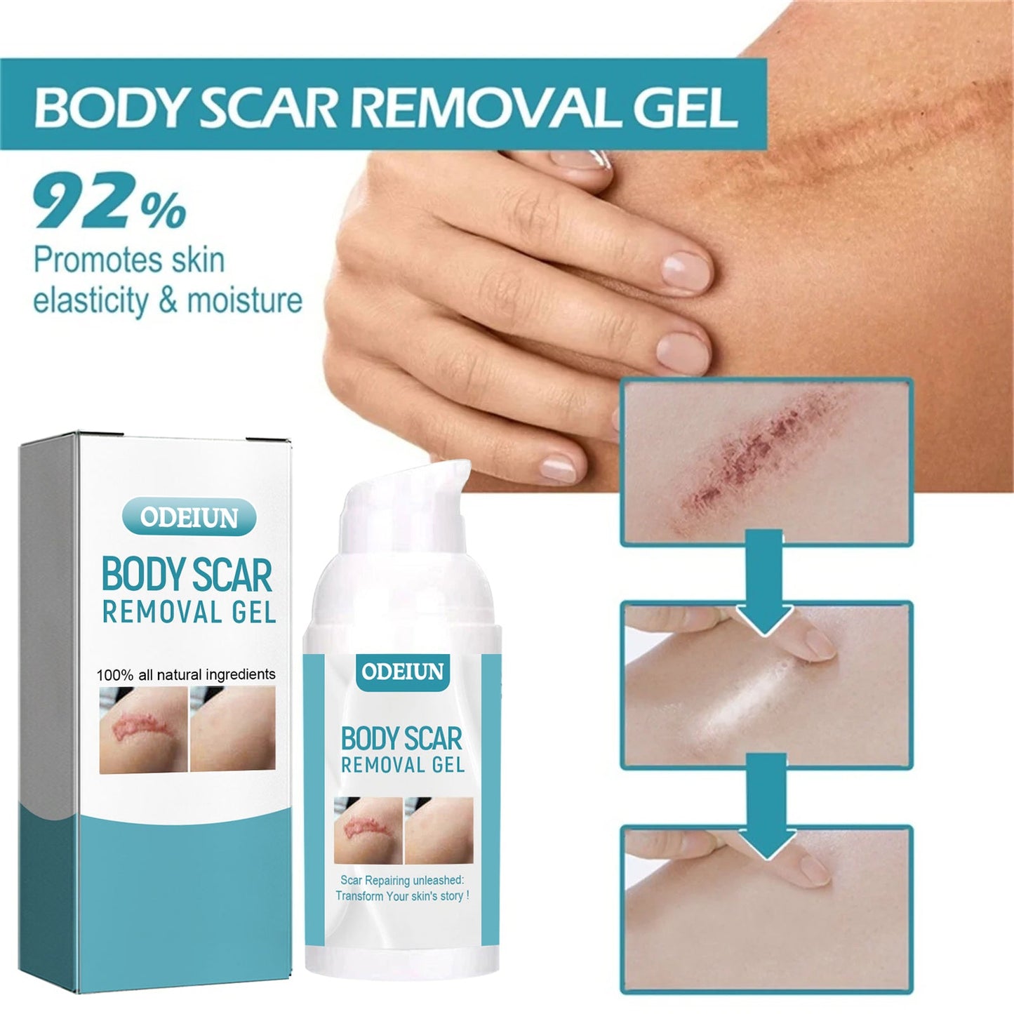 SCAR SOLUTIONS SILICONE SCAR GEL