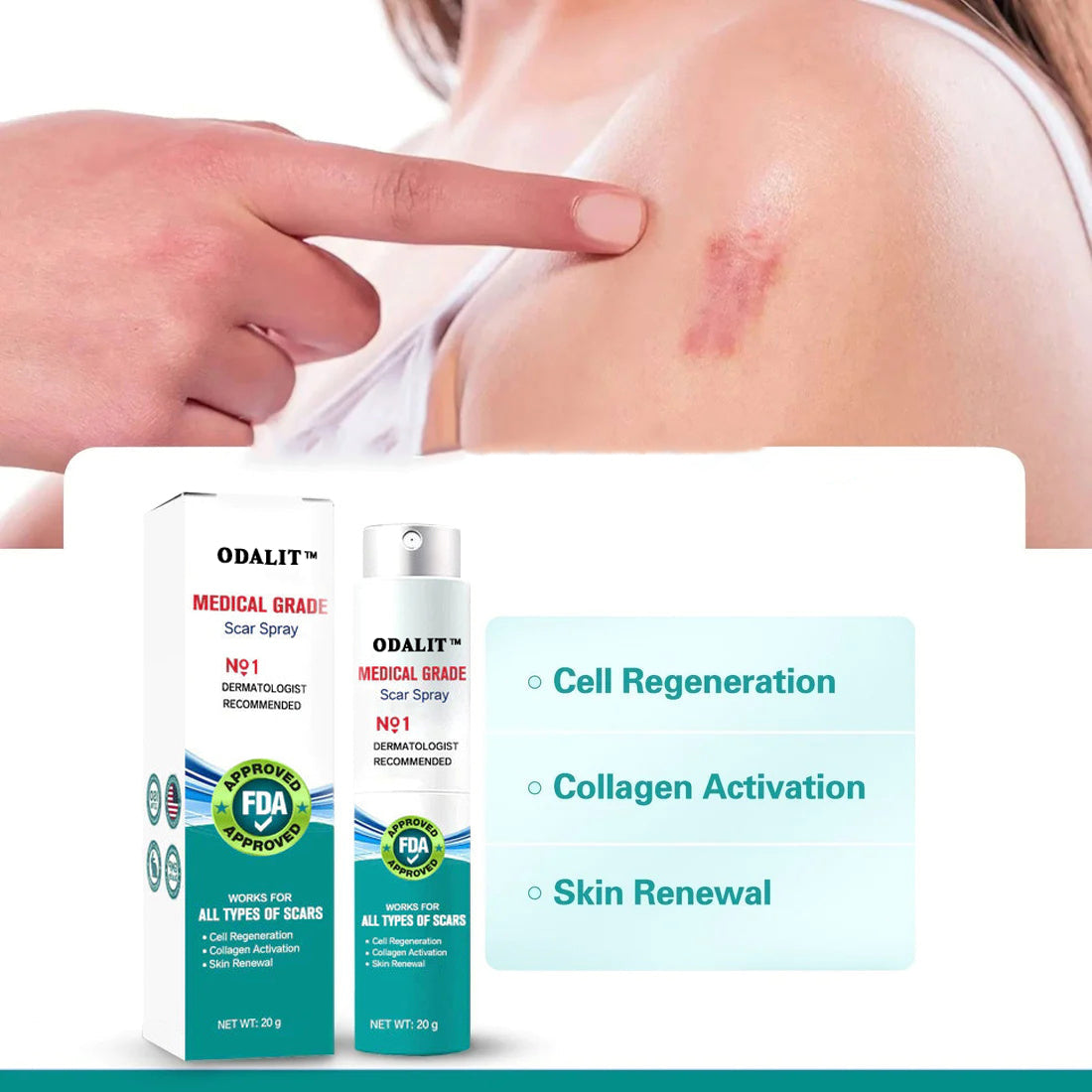 ❤️Advanced Scar Spray For All Types of Scars - For example Acne Scars, Surgical Scars and Stretch Marks ⚡️⚡️⚡️