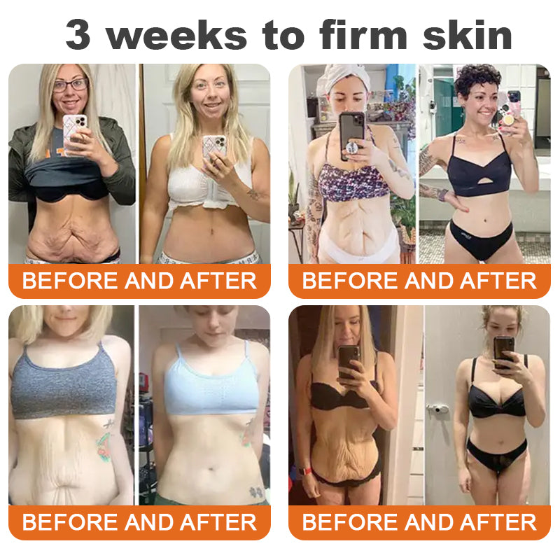 ✨Made and Shipped from USA ✨✨ ODALIT™ Bee venom Comprehensive Cream 🔥 LAST DAY 80% OFF 💎💎