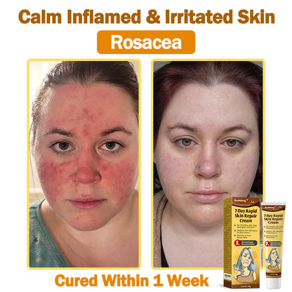 NEGUSY™ 7-Day Intensive Skin Repair Cream | FDA Certified & Doctor Recommended 🌟👩‍⚕️
