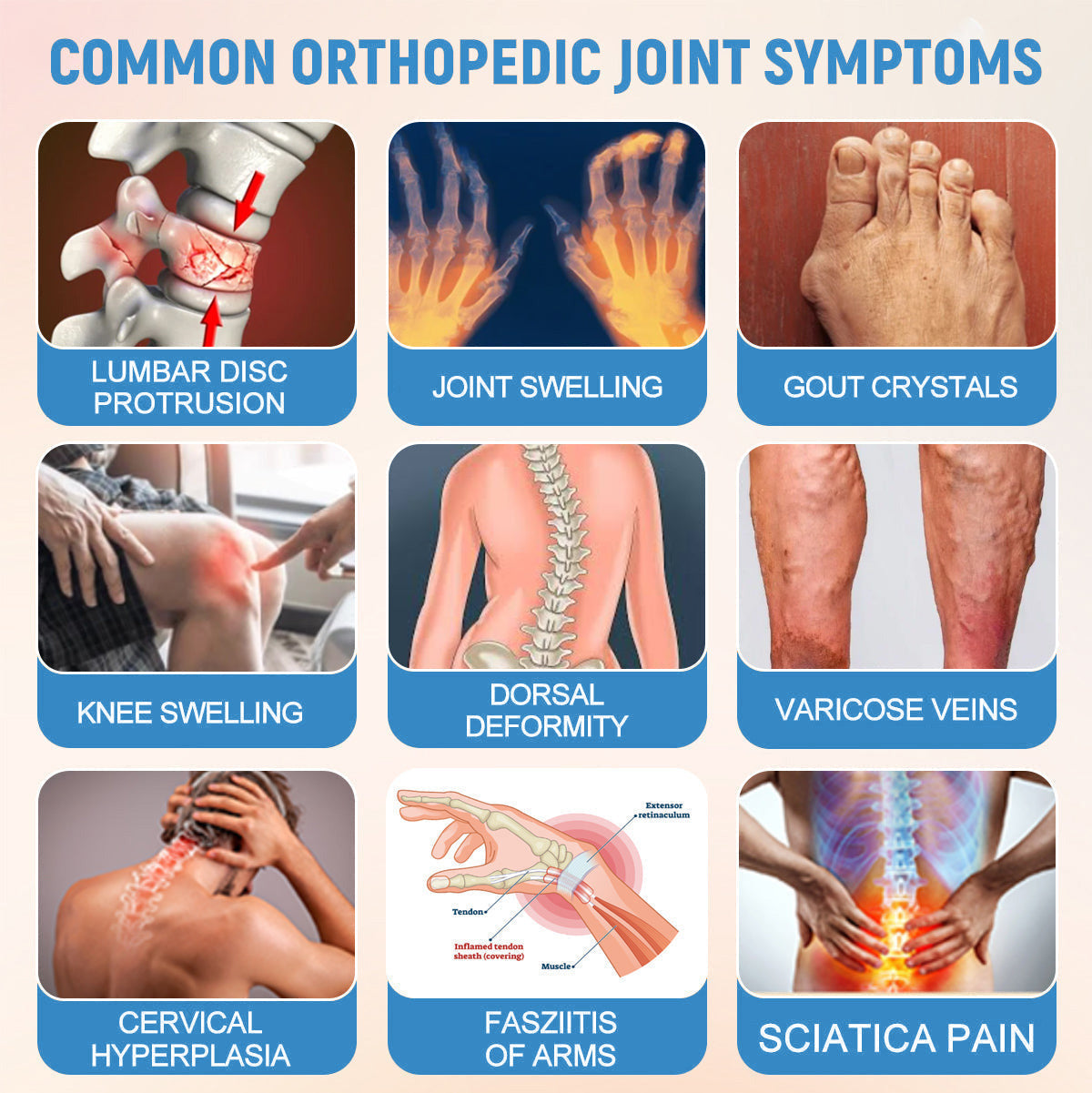 Official Store：👩‍⚕️Recommended by AAOS🦾ODALIT® Nano-microneedle joint patch (Painless, long-lasting, suitable for arthritis, varicose veins and various orthopedic diseases)