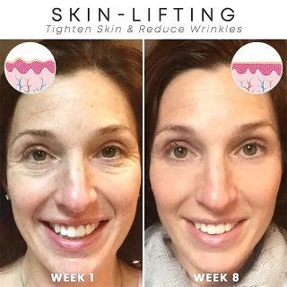 💝 Last Day Promotion 60% OFF 💝 Anti-Wrinkle Firming B5 Serum