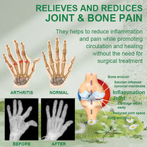 🐝NEGUSY®New Zealand Bee Venom Joint and Bone Therapy Advanced Cream⏳Limited time discount of 80%⏳