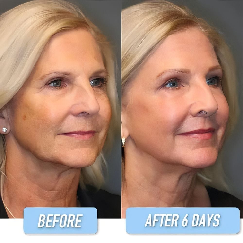 💝 Last Day Promotion 60% OFF 💝 Anti-Wrinkle Firming B5 Serum