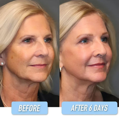 💝 Last Day Promotion 60% OFF 💝 Anti-Wrinkle Firming B5 Serum