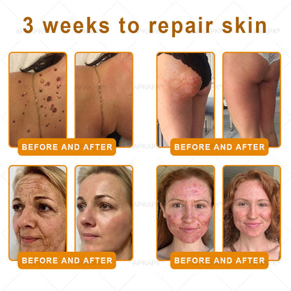 ODALIT™ | Eliminates wrinkles and firms sagging skin in 7 days.