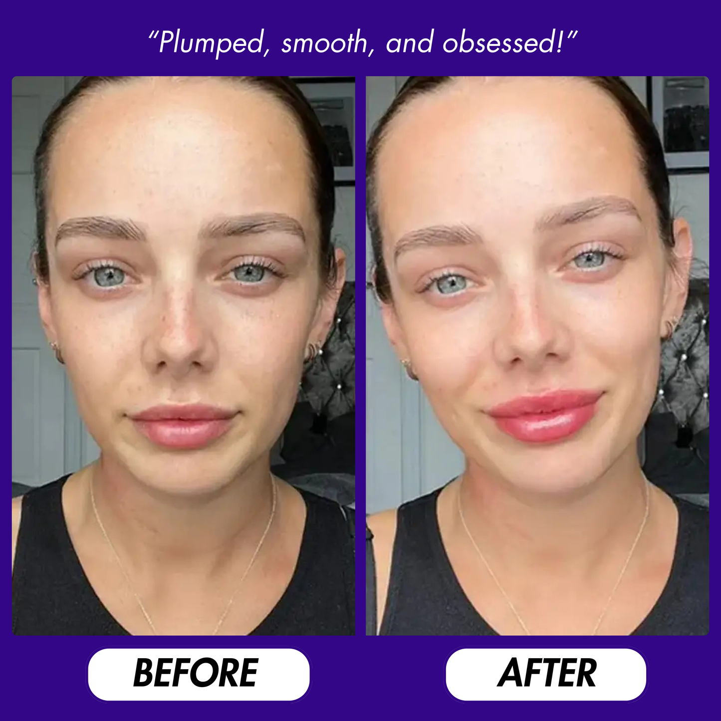 2-in-1 Lip Booster