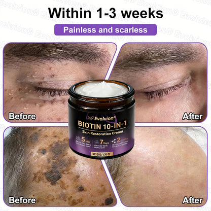 Made and Shipped from USA ✨Evolvion® Biotin 10-in-1 Skin Restoration Cream 🍀