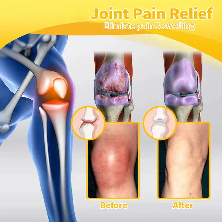 💧🐝PolarFresh® Magnesium Oil & Bee Venom Pain-Relief Bone Healing Cream👨‍⚕️Approved by the American Academy of Orthopaedic Surgeons (AAOS)