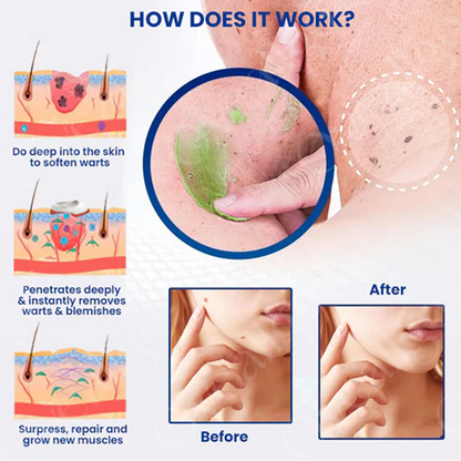 ✅ Official Store: Oveallgo® NatureErase Instant Alligator Oil Mole & Spot Removal Plus Gel