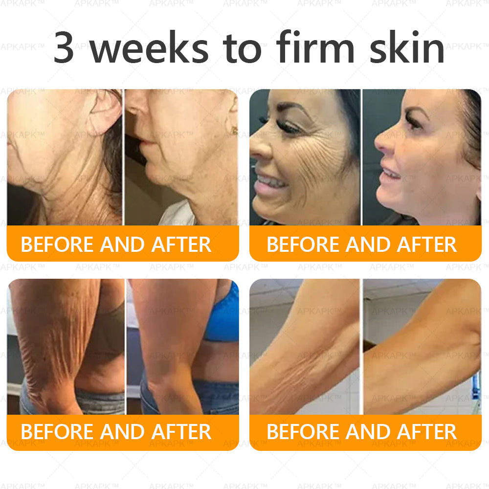 ODALIT™ | Eliminates wrinkles and firms sagging skin in 7 days.