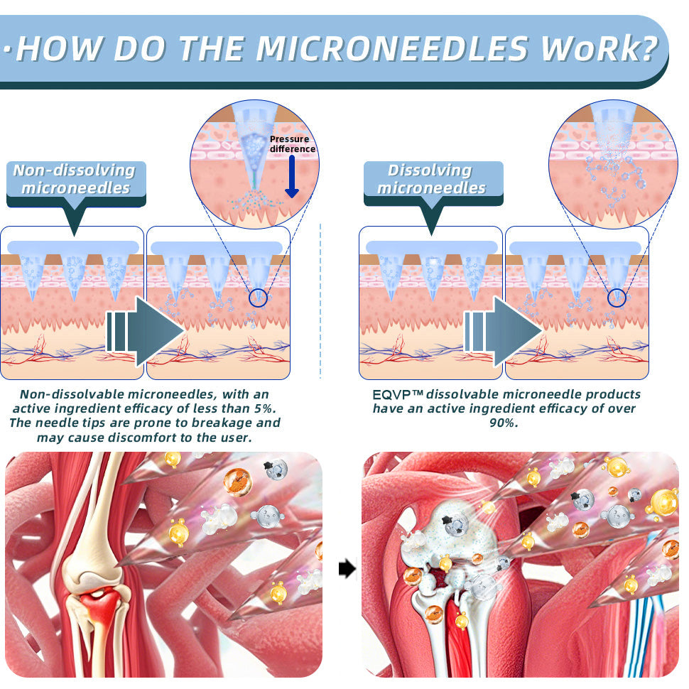 Official Store：👩‍⚕️Recommended by AAOS🦾ODALIT® Nano-microneedle joint patch (Painless, long-lasting, suitable for arthritis, varicose veins and various orthopedic diseases)
