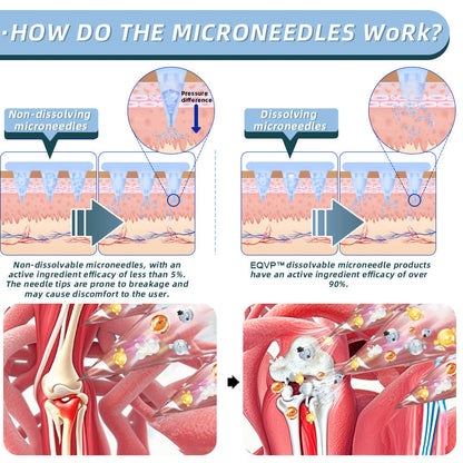 Official Store：👩‍⚕️Recommended by AAOS🦾ODALIT® Nano-microneedle joint patch (Painless, long-lasting, suitable for arthritis, varicose veins and various orthopedic diseases)