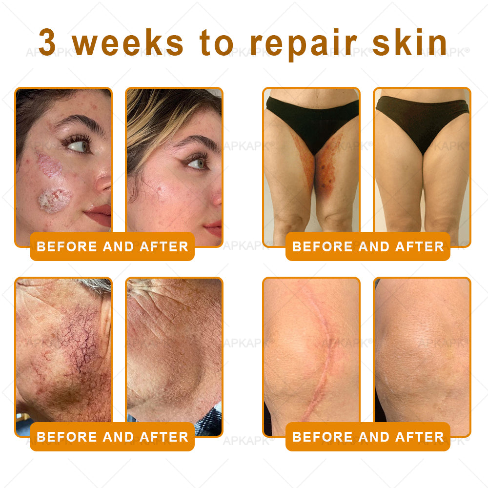 ODALIT™ | Eliminates wrinkles and firms sagging skin in 7 days.