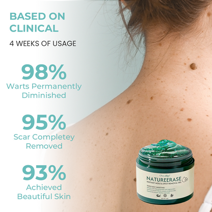 ✅ Official Store: Oveallgo® NatureErase Instant Alligator Oil Mole & Spot Removal Plus Gel