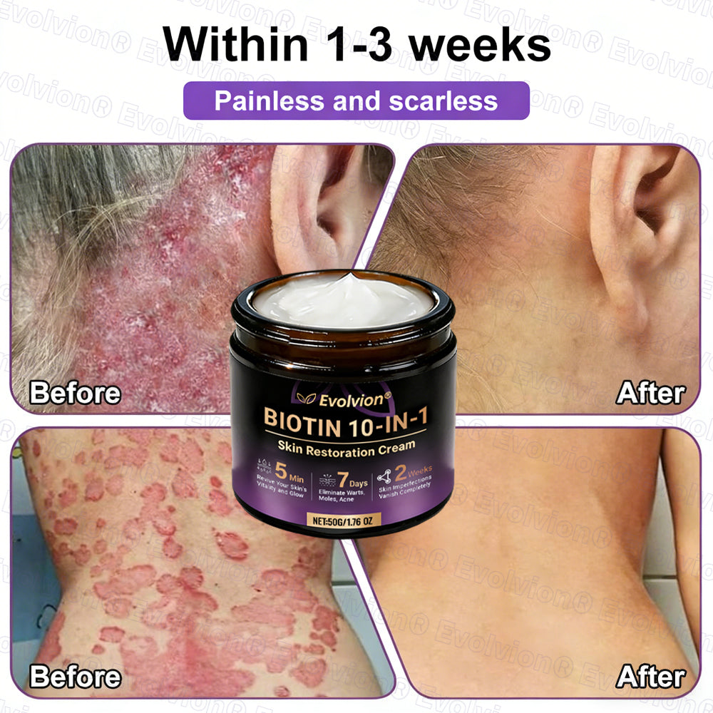 Made and Shipped from USA ✨Evolvion® Biotin 10-in-1 Skin Restoration Cream 🍀