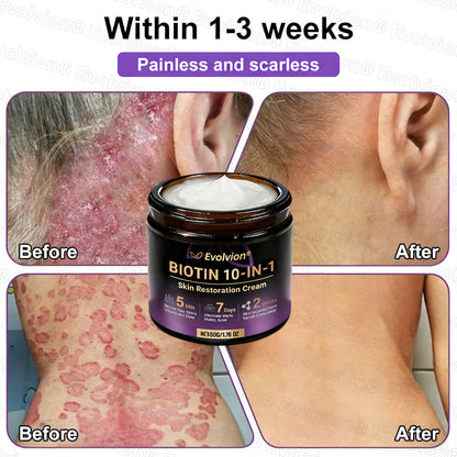 Made and Shipped from USA ✨Evolvion® Biotin 10-in-1 Skin Restoration Cream 🍀