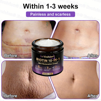 Made and Shipped from USA ✨Evolvion® Biotin 10-in-1 Skin Restoration Cream 🍀