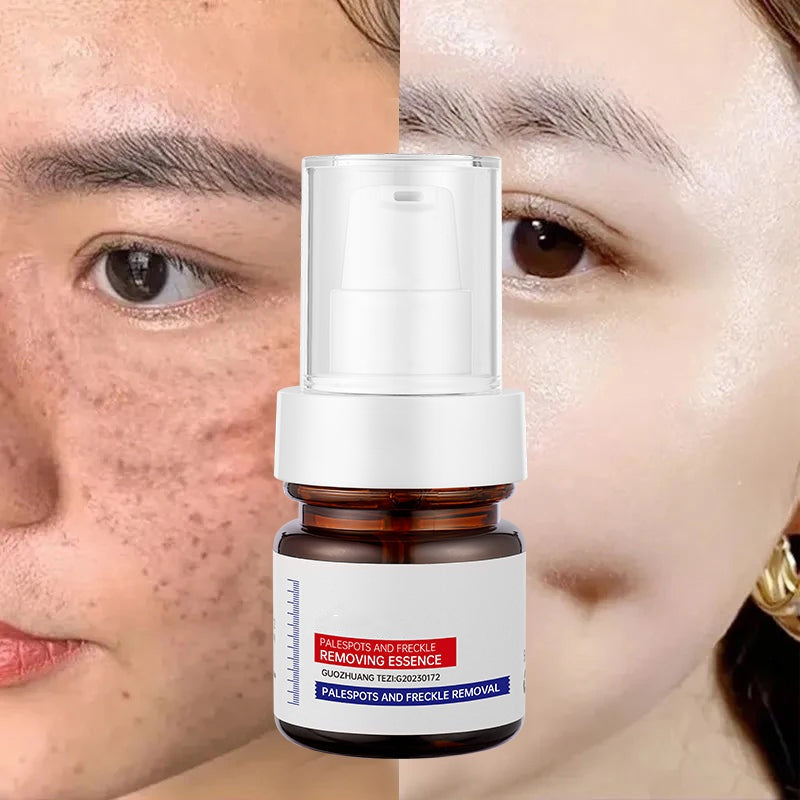 ✨FLASH SALE：⚡5-second brightening rescue: Dark spots disappear, blemishes fade, and skin becomes radiant! Vitamin C Whitening Freckles ESSENCE