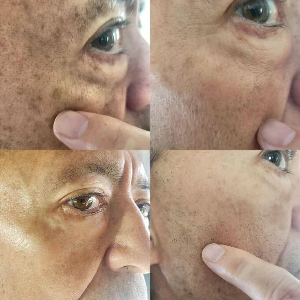 ✨Seurico™ Rapid Dark Spot Eraser – Melanin Correcting Facial Serum🔥