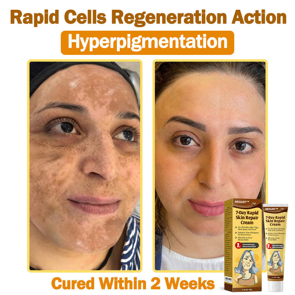 NEGUSY™ 7-Day Intensive Skin Repair Cream | FDA Certified & Doctor Recommended 🌟👩‍⚕️