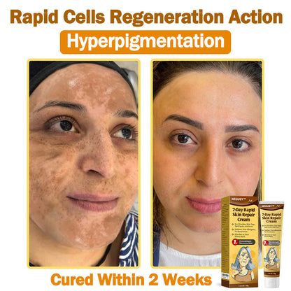 NEGUSY™ 7-Day Intensive Skin Repair Cream | FDA Certified & Doctor Recommended 🌟👩‍⚕️