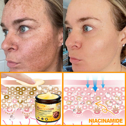 Made and Shipped from USA 🎇 VLSVLS® Bee Venom Skin Restoration Cream 🔥 LAST DAY 80% OFF🎇