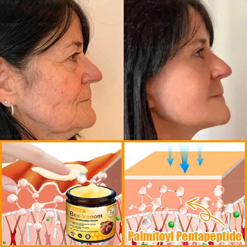 Made and Shipped from USA 🎇 VLSVLS® Bee Venom Skin Restoration Cream 🔥 LAST DAY 80% OFF🎇