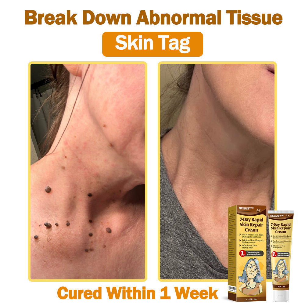 NEGUSY™ 7-Day Intensive Skin Repair Cream | FDA Certified & Doctor Recommended 🌟👩‍⚕️