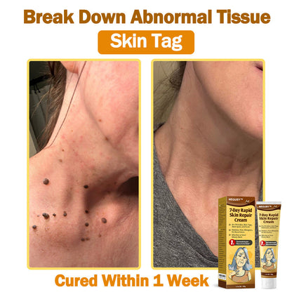NEGUSY™ 7-Day Intensive Skin Repair Cream | FDA Certified & Doctor Recommended 🌟👩‍⚕️