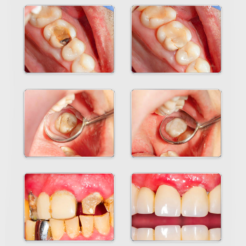 Oraliz™ Repair Teeth Anti-Decay - Hydroxyapatite Toothpastea
