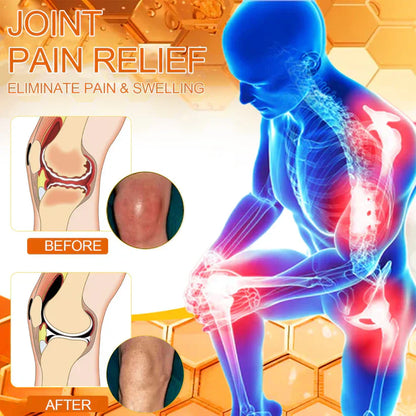💧🐝PolarFresh® Magnesium Oil & Bee Venom Pain-Relief Bone Healing Cream👨‍⚕️Approved by the American Academy of Orthopaedic Surgeons (AAOS)