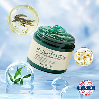 ✅ Official Store: Oveallgo® NatureErase Instant Alligator Oil Mole & Spot Removal Plus Gel
