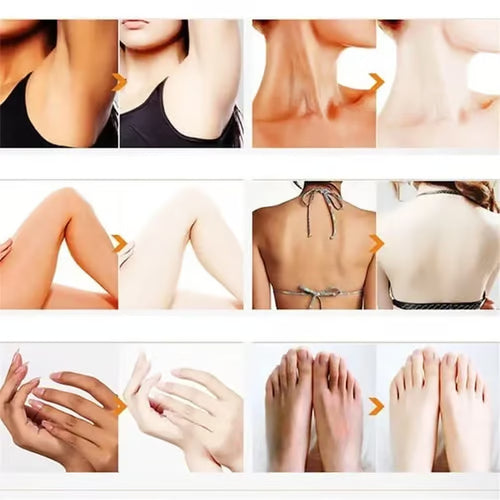 【Hot Sale】NEGUSY® Purifying Exfoliating Gel