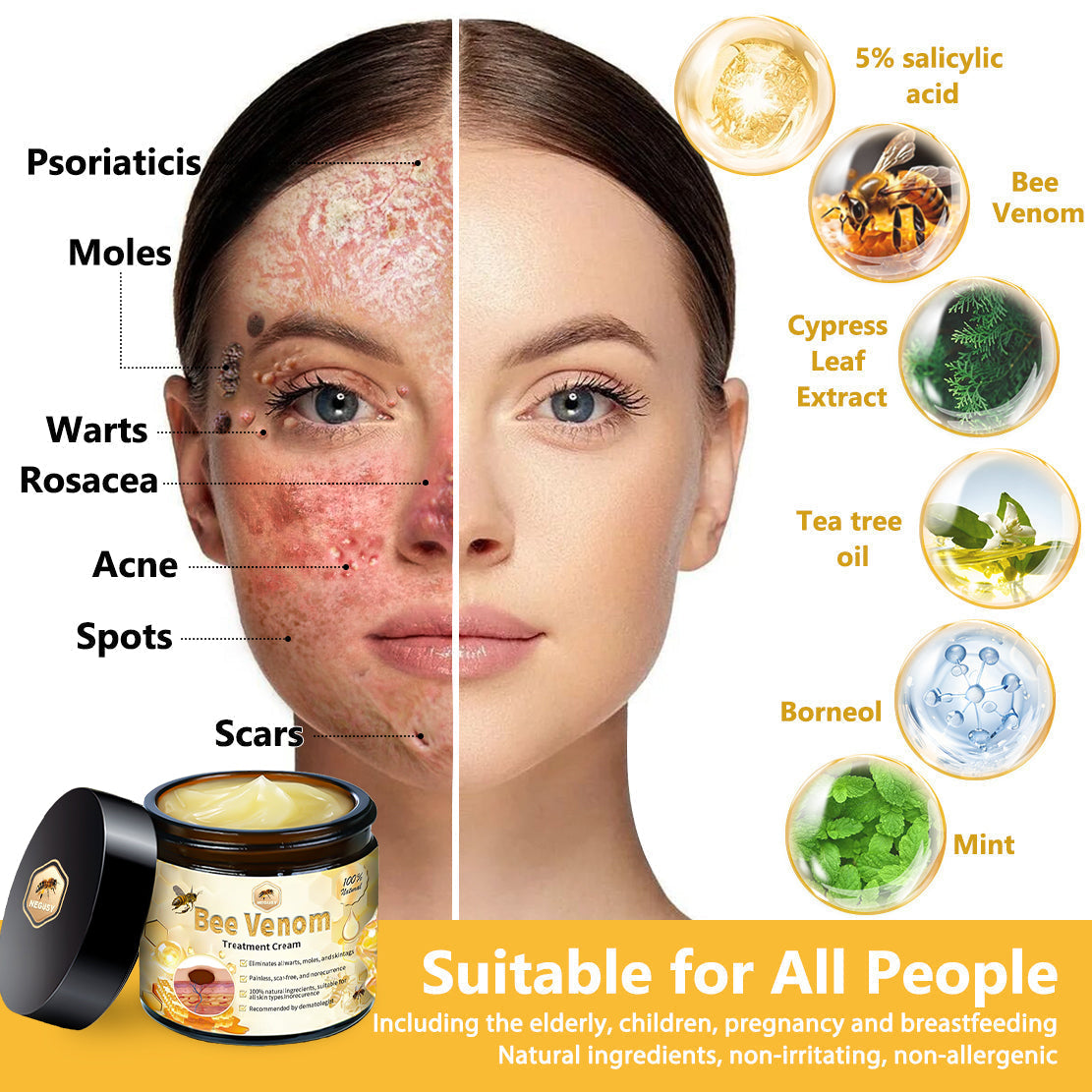NEGUSY™ Bee Venom Skin Treatment Cream (AAD Recommended)