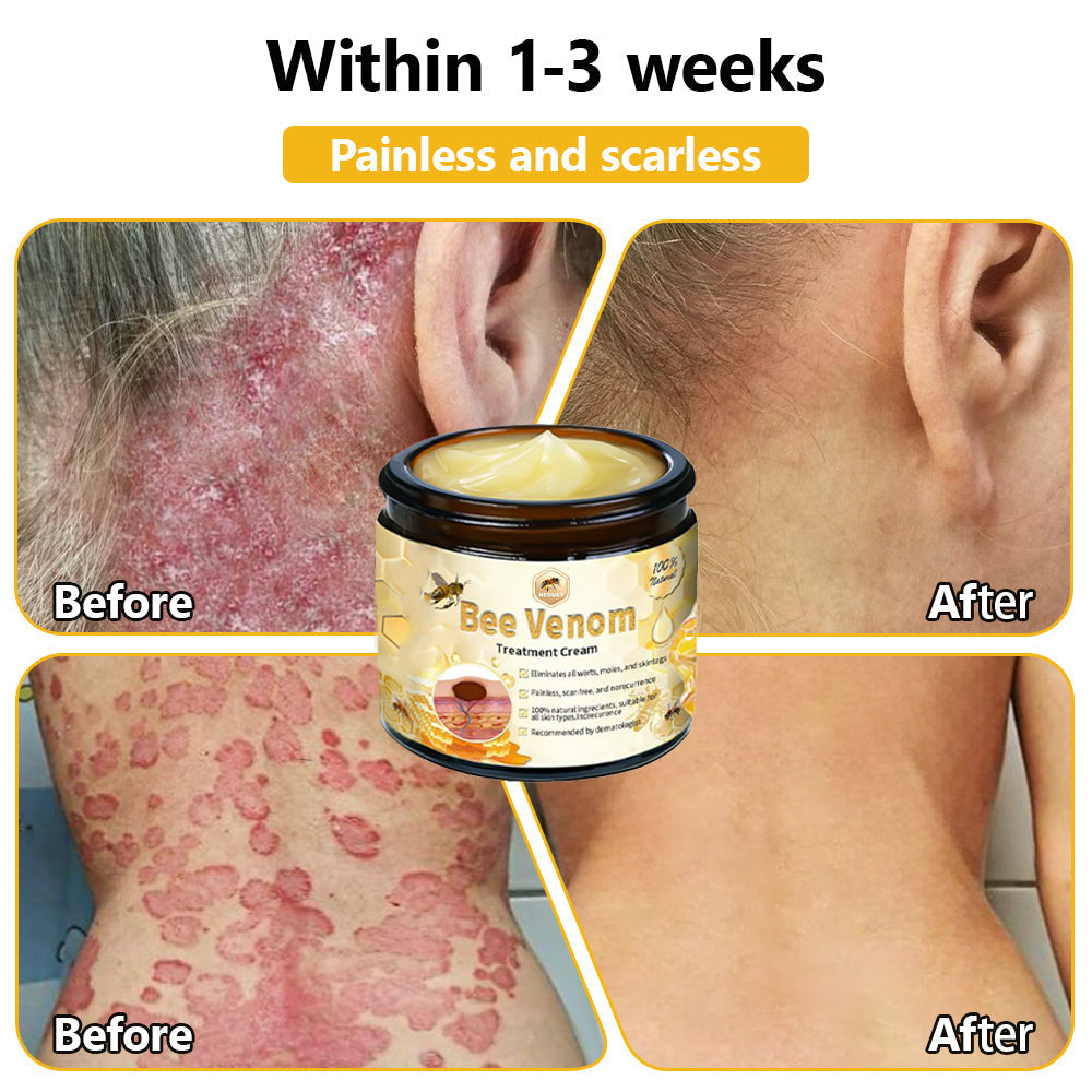 NEGUSY™ Bee Venom Skin Treatment Cream (AAD Recommended)