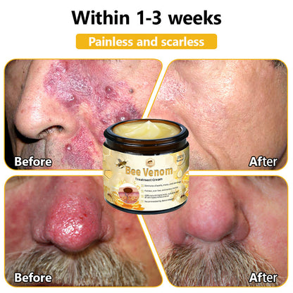 NEGUSY™ Bee Venom Skin Treatment Cream (AAD Recommended)