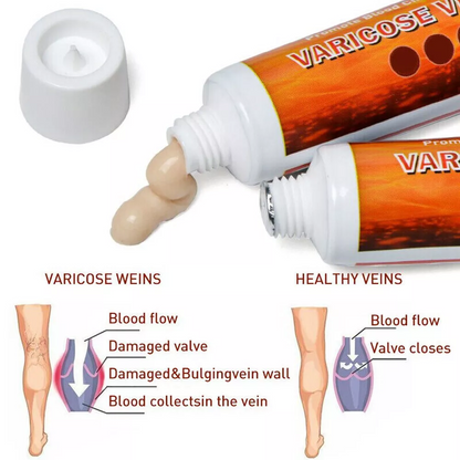 VeinRescue™ Veins Cream: Complete Treatment for Varicose Veins