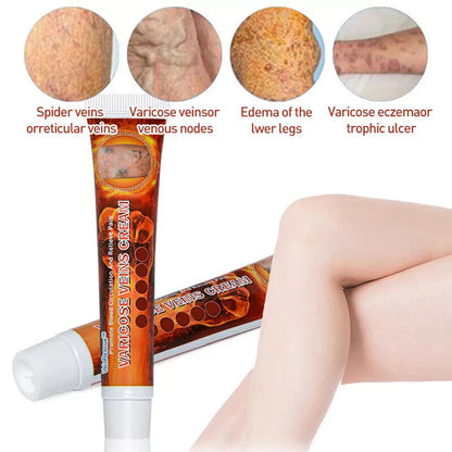 VeinRescue™ Veins Cream: Complete Treatment for Varicose Veins