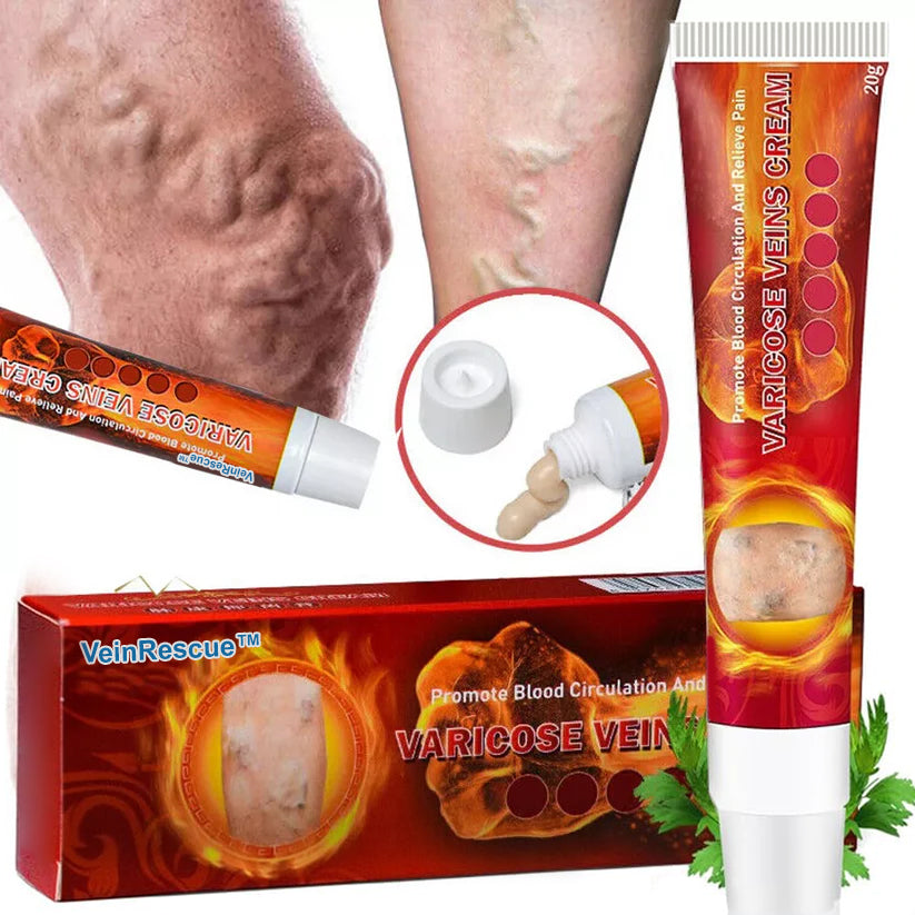 VeinRescue™ Veins Cream: Complete Treatment for Varicose Veins