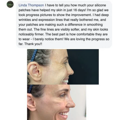 ReviveScars™ - Silicone Scar Sheets