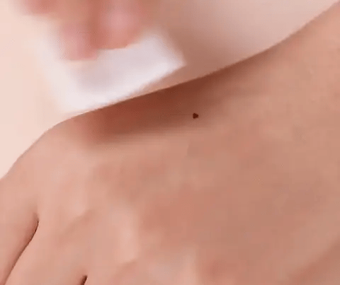 Pain-Free Cleansing Pen: Remove Skin Tags, Warts & Moles In Minutes Without Pain or Scarring