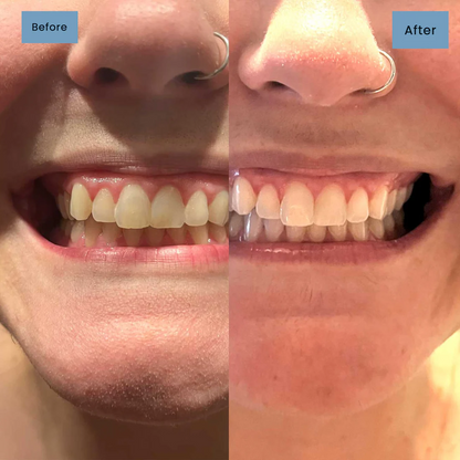 🔥Niacinamide Intensive Whitening Toothpaste