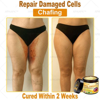 Skin Tags, Eczema, or Psoriasis? This 15-Minute Bee Venom Cream Soothes, Heals & Clears Fast—No Steroids, No Scars