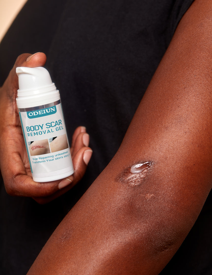 SCAR SOLUTIONS SILICONE SCAR GEL