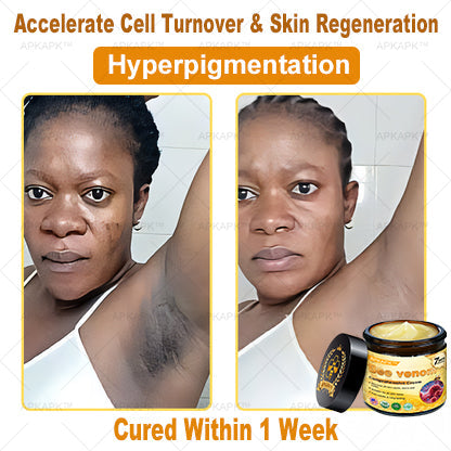 Skin Tags, Eczema, or Psoriasis? This 15-Minute Bee Venom Cream Soothes, Heals & Clears Fast—No Steroids, No Scars