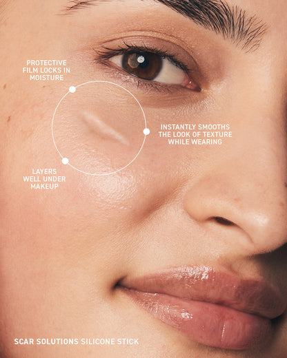 SCAR SOLUTIONS SILICONE SCAR GEL