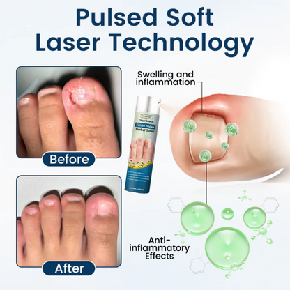 Fivfivgo® OnyxiGuard PRO Fungal Repair Herbal Spray