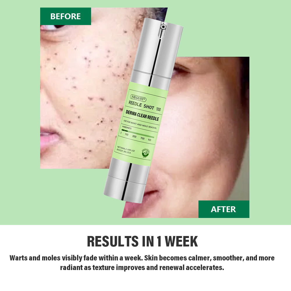 NEGUSY® USA DermaClear Reedle Shot 100 Wart & Mole Eraser Serum